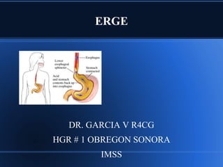 ERGE
DR. GARCIA V R4CG
HGR # 1 OBREGON SONORA
IMSS
 