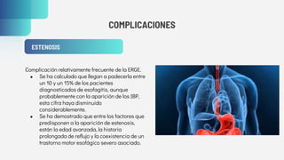 COMPLICACIONES
ESTENOSIS
Complicación relativamente frecuente de la ERGE.
● Se ha calculado que llegan a padecerla entre
un 10 y un 15% de los pacientes
diagnosticados de esofagitis, aunque
probablemente con la aparición de los IBP,
esta cifra haya disminuido
considerablemente.
● Se ha demostrado que entre los factores que
predisponen a la aparición de estenosis,
están la edad avanzada, la historia
prolongada de reflujo y la coexistencia de un
trastorno motor esofágico severo asociado.
 
