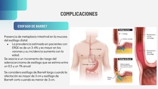 COMPLICACIONES
ESOFAGO DE BARRET
Presencia de metaplasia intestinal en la mucosa
del esófago distal.
● La prevalencia estimada en pacientes con
ERGE es de un 3-4% y es mayor en los
varones y su incidencia aumenta con la
edad.
Se asocia a un incremento de riesgo del
adenocarcinoma de esófago que se estima entre
un 0,5 y un 1% anual
Se considera esófago de Barrett largo cuando la
afectación es mayor de 3 cm y esófago de
Barrett corto cuando es menor de 3 cm.
 