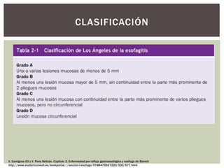CLASIFICACIÓN
V. Garrigues Gil y V. Pons Beltrán. Capítulo 2. Enfermedad por reflujo gastroesofágico y esófago de Barrett
http://www.studentconsult.es/bookportal///seccion-i-esofago/9788475927220/500/677.html
 