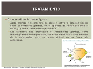  Otras medidas farmacológicas
 Acido algínico + bicarbonato de sodio + saliva  solución viscosa
sobre el contenido gástrico, en el episodio de reflujo asciende al
esófago y actúa como barrera protectora.
 Los fármacos que promueven el vaciamiento gástrico, como
metoclopramida o domperidona, son útiles durante las fases iniciales
de la enfermedad, pero no tienen utilidad en las fases más
avanzadas.
TRATAMIENTO
Brunicardi et al. Schwartz. Principios de Cirugía. 9na edición. McGraw Hill
 