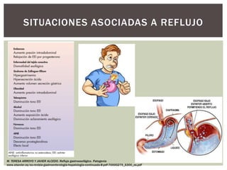 SITUACIONES ASOCIADAS A REFLUJO
M. TERESA ARROYO Y JAVIER ALCEDO. Reflujo gastroesofágico. Patogenia
www.elsevier.es/es-revista-gastroenterologia-hepatologia-continuada-8-pdf-70000275_S300_es.pdf
 