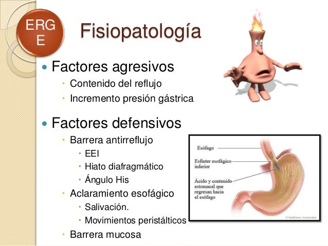 Reflujo gastroesofágico en Pediatría