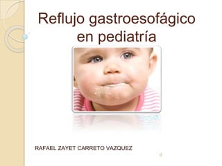 Reflujo gastroesofágico
en pediatría
RAFAEL ZAYET CARRETO VAZQUEZ
0
 