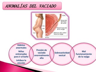 Hábitos
anormales
Niñas
entrenadas
para ir al baño
Inhiben la
micción
Presión de
vaciado
anormalmente
alta
Sobreactividad
vesical
Mal
funcionamiento
de la vejiga
ANOMALÍAS DEL VACIADO
 