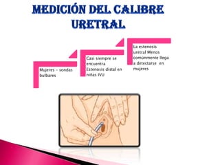 Mujeres – sondas
bulbares
Casi siempre se
encuentra
Estenosis distal en
niñas IVU
La estenosis
uretral Menos
comúnmente llega
a detectarse en
mujeres
 