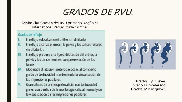 reflujo-vesicoureteral