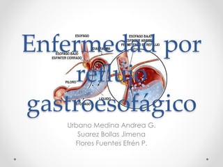 Enfermedad por
reflujo
gastroesofágico
Urbano Medina Andrea G.
Suarez Bollas Jimena
Flores Fuentes Efrén P.
 