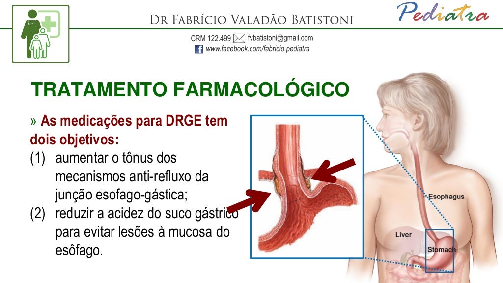 Com Sintomas De Azia E Refluxo Gastroesofágico Sergio Nao Consegue