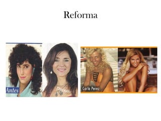 Reforma 