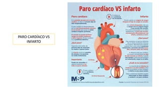 PARO CARDÍACO VS
INFARTO
 