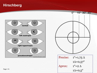 Hirschberg 15° 0 ° 30 ° 4 5° Pr ecise : 1°=1,75   1  =0,57° Ap rox : 1°=2   1  =0,5° 