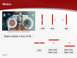 Madox orto eso exo orto hipo (od) hiper (os) Mado x  c ylinder   in fron of OD hipo (o s ) hiper (o d ) 
