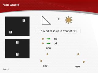 Von Graefe + 5-6 pd  base up in front of OD os od e x o e s o orto 