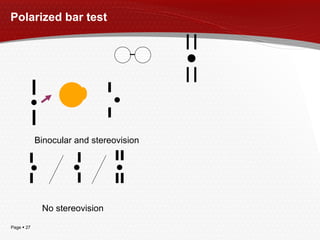 Polarized bar test Bino cular and  stere ovision N o  stereo vision 