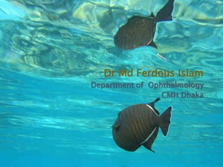 Dr Md Ferdous Islam
Department of Ophthalmology
CMH Dhaka
 