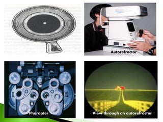 Pinhole glasses Autorefractor
View through an autorefractorPhoropter
 