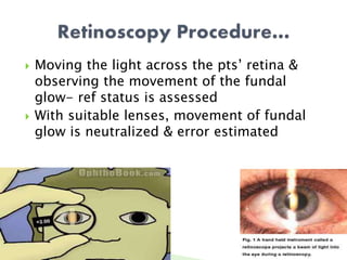  Moving the light across the pts’ retina &
observing the movement of the fundal
glow- ref status is assessed
 With suitable lenses, movement of fundal
glow is neutralized & error estimated
 