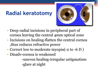 Photorefractive
keratectomy(PRK)
• Central optical zone of anterior
corneal stroma is photoablated
using EXCIMER laser(193...