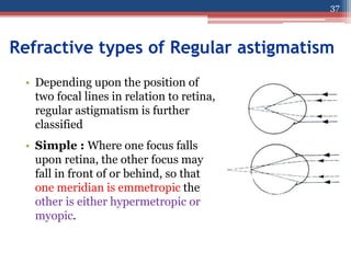 Refractive types of Regular astigmatism
• Depending upon the position of
two focal lines in relation to retina,
regular astigmatism is further
classified
• Simple : Where one focus falls
upon retina, the other focus may
fall in front of or behind, so that
one meridian is emmetropic the
other is either hypermetropic or
myopic.
37
 