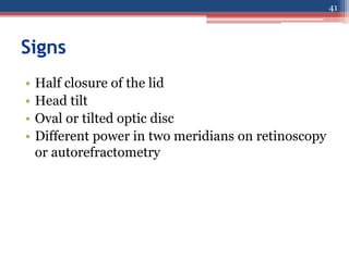 Signs
• Half closure of the lid
• Head tilt
• Oval or tilted optic disc
• Different power in two meridians on retinoscopy
or autorefractometry
41
 