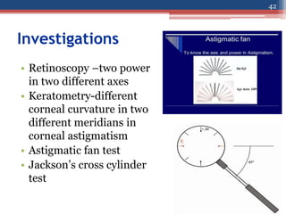 Investigations
• Retinoscopy –two power
in two different axes
• Keratometry-different
corneal curvature in two
different meridians in
corneal astigmatism
• Astigmatic fan test
• Jackson’s cross cylinder
test
42
 