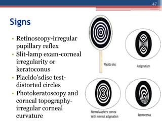 Signs
• Retinoscopy-irregular
pupillary reflex
• Slit-lamp exam-corneal
irregularity or
keratoconus
• Placido’sdisc test-
distorted circles
• Photokeratoscopy and
corneal topography-
irregular corneal
curvature
47
 