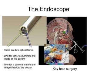 The Endoscope There are two optical fibres One for light, to illuminate the inside of the patient One for a camera to send the images back to the doctor.  Key hole surgery 