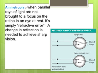 Ammetropia :- when parallel
rays of light are not
brought to a focus on the
retina in an eye at rest. It’s
simply “refractive error”. A
change in refraction is
needed to achieve sharp
vision.
 