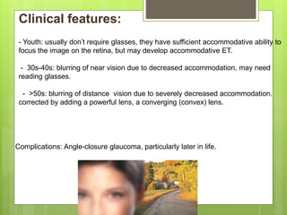 Clinical features:
- Youth: usually don’t require glasses, they have sufficient accommodative ability to
focus the image on the retina, but may develop accommodative ET.
- 30s-40s: blurring of near vision due to decreased accommodation, may need
reading glasses.
- >50s: blurring of distance vision due to severely decreased accommodation.
corrected by adding a powerful lens, a converging (convex) lens.
Complications: Angle-closure glaucoma, particularly later in life.
 