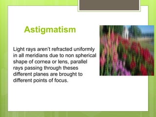 Astigmatism
Light rays aren’t refracted uniformly
in all meridians due to non spherical
shape of cornea or lens, parallel
rays passing through theses
different planes are brought to
different points of focus.
 