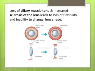 Loss of ciliary muscle tone & Increased
sclerosis of the lens leads to loss of flexibility
and inability to change lens shape.
 