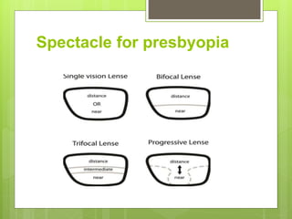 Spectacle for presbyopia
 