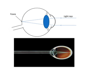 Fovea
        Light rays
 