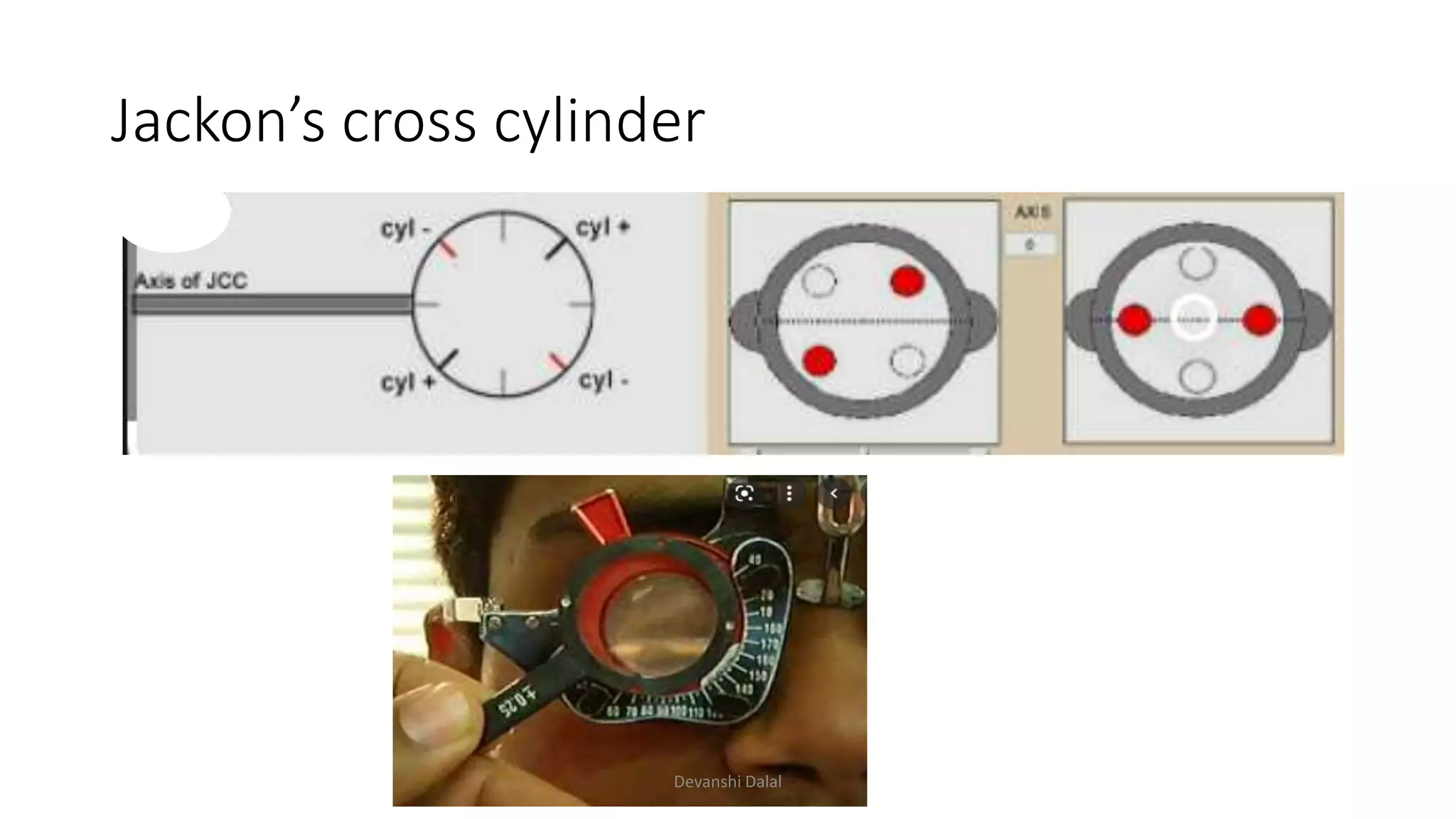Jackon’s cross cylinder
Devanshi Dalal
 