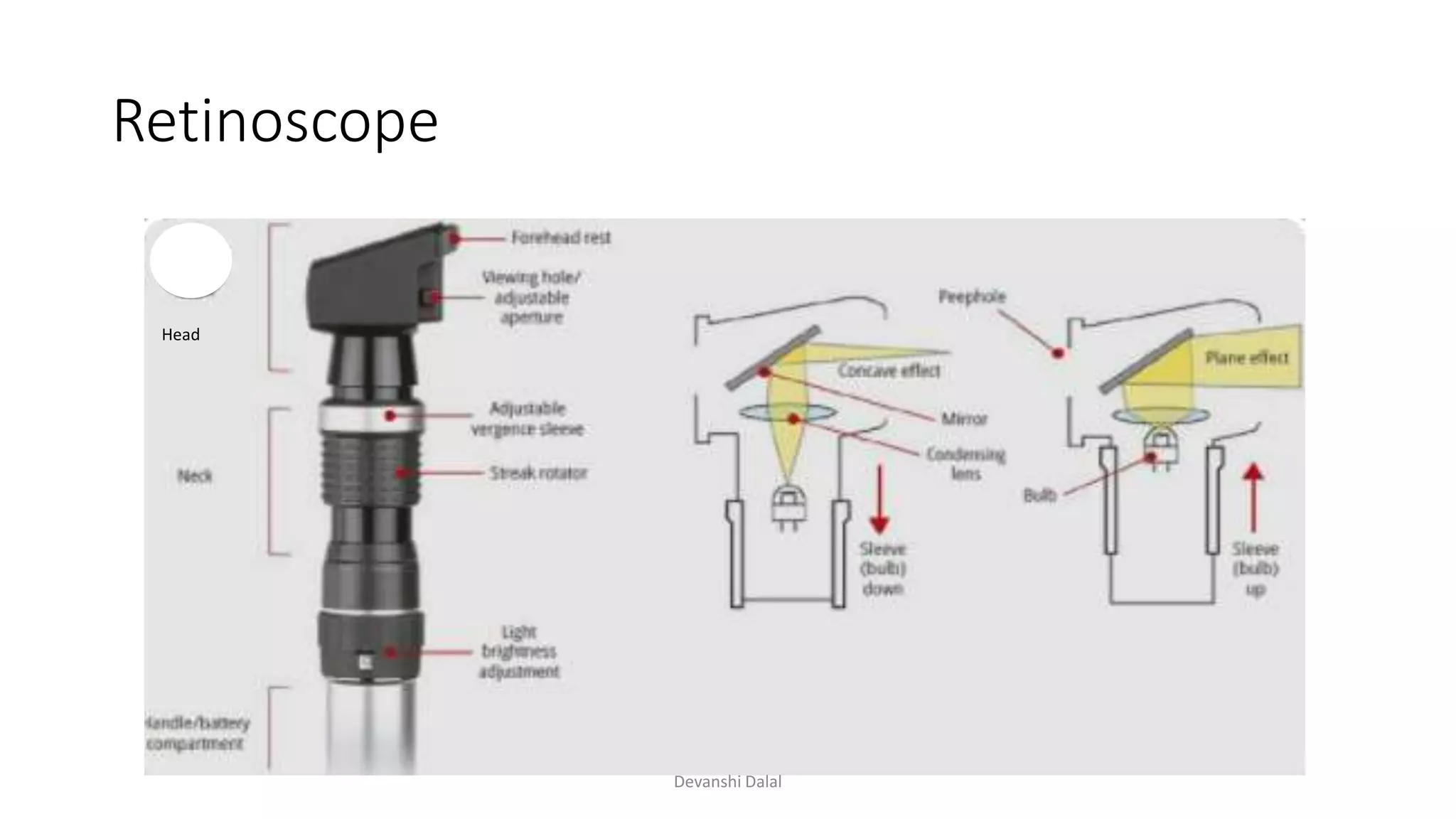 Retinoscope
Head
Devanshi Dalal
 