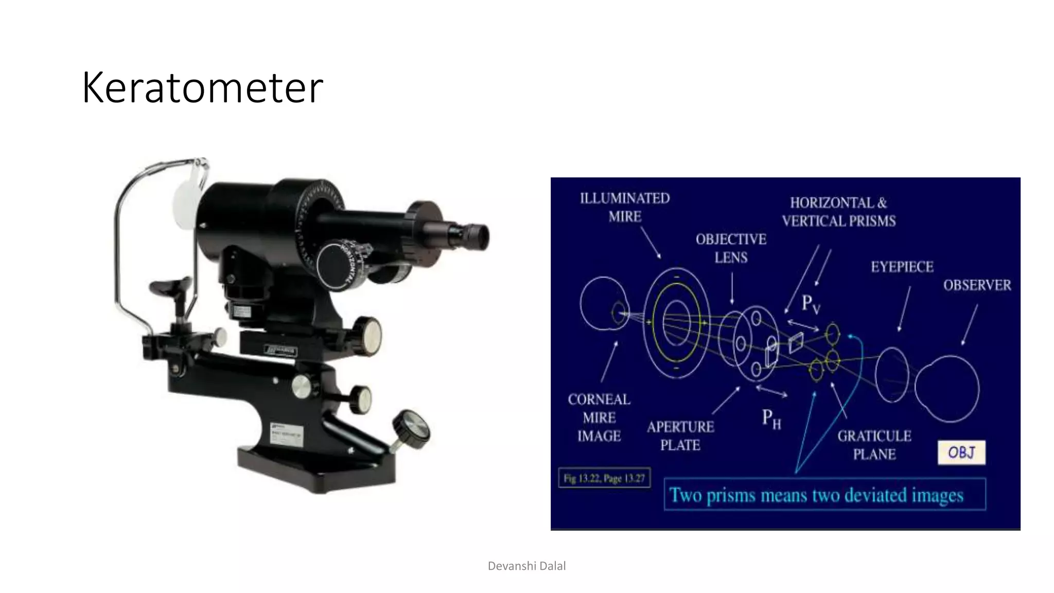 Keratometer
Devanshi Dalal
 