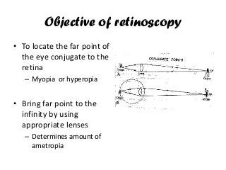Objective of retinoscopy
• To locate the far point of
the eye conjugate to the
retina
– Myopia or hyperopia
• Bring far point to the
infinity by using
appropriate lenses
– Determines amount of
ametropia
 