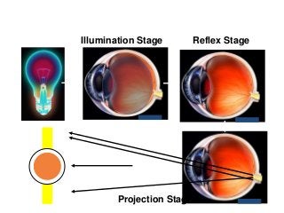 Illumination Stage Reflex Stage
Projection Stage
 