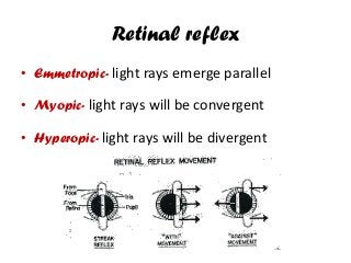 Retinal reflex
• Emmetropic- light rays emerge parallel
• Myopic- light rays will be convergent
• Hyperopic- light rays will be divergent
 