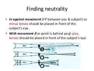 Finding neutrality
• In against movement (FP between you & subject) so
minus lenses should be placed in front of the
subject’s eye.
 With movement (Far point is behind you): plus
lenses should be placed in front of the subject’s eye.
 