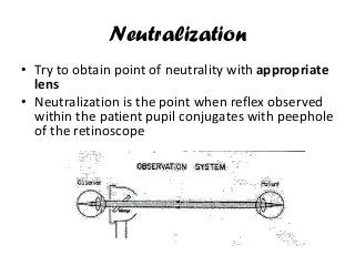 Neutralization
• Try to obtain point of neutrality with appropriate
lens
• Neutralization is the point when reflex observed
within the patient pupil conjugates with peephole
of the retinoscope
 