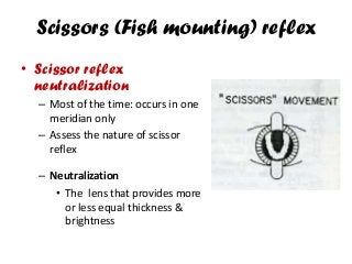 Scissors (Fish mounting) reflex
• Scissor reflex
neutralization
– Most of the time: occurs in one
meridian only
– Assess the nature of scissor
reflex
– Neutralization
• The lens that provides more
or less equal thickness &
brightness
 