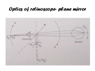 Optics of retinoscope- plane mirror
 
