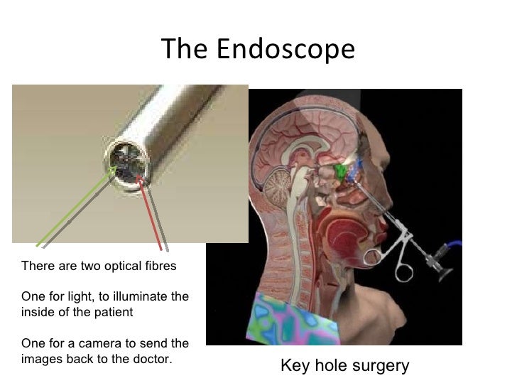 Refraction Snell Tir
