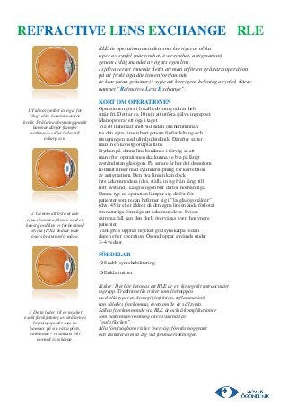 REFRACTIVE LENS EXCHANGE RLE
                                   RLE är operationsmetoden som korrigerar olika
                                   typer av synfel (närsynthet, översynthet, astigmatism)
                                   genom avlägsnandet av ögats egen lins.
                                   I själva verket innebär detta att man utför en gråstarrsoperation
                                   på ett friskt öga där linsen fortfarande
                                   är klar (utan gråstarr) i syfte att korrigera befintliga synfel, därav
                                   namnet ”Refractive Lens Exchange”.

                                   KORT OM OPERATIONEN
  1.Vid närsynthet är ögat för     Operationen görs i lokalbedövning och är helt
   långt eller hornhinnan för      smärtfri. Det tar ca 10 min att utföra själva ingreppet.
krökt. Strålarnas brytningspunkt   Man opererar ett öga i taget.
     hamnar därför framför         Via ett minimalt snitt vid sidan om hornhinnan
    näthinnan vilket leder till    tas den egna linsen bort genom finfördelning och
           oskarp syn.             utsugningen med ultraljudsteknik. Därefter sätter
                                   man in en konstgjord plastlins.
                                   Styrkan på denna lins beräknas i förväg så att
                                   man efter operationen ska kunna se bra på långt
                                   avstånd utan glasögon. På senare år har det dessutom
                                   kommit linser med cylinderslipning för korrektion
                                   av astigmatism. Den nya linsen kan dock
                                   inte ackommodera (dvs. ställa in sig från långt till
                                   kort avstånd). Läsglasögon blir därför nödvändiga.
                                   Denna typ av operation lämpar sig därför för
                                   patienter som redan befinner sig i ”läsglasögonålder”
                                   (dvs. 45 år eller äldre) då den egna linsen ändå förlorat
   2. Genom att byta ut den        sin naturliga förmåga att ackommodera. I vissa
 egna (humana) linsen med en       extrema fall kan den dock övervägas även hos yngre
 konstgjord lins av förbestämd     patienter.
   styrka (IOL) ändrar man         Vanligtvis uppnås mycket god synskärpa redan
   ögats brytningsförmåga.         dagen efter operation. Ögondroppar används under
                                   3–4 veckor.

                                   FÖRDELAR
                                   ❍ Snabb synrehabilitering
                                   ❍ Enkla rutiner

                                   Risker: Det bör betonas att RLE är ett kirurgiskt intraoculärt
                                   ingrepp. Traditionella risker som förknippas
                                   med alla typer av kirurgi (infektion, inflammation)
                                   kan således förekomma, även om de är sällsynta.
  3. Detta leder till en mycket    Sällan förekommande vid RLE är också komplikationer
exakt förskjutning av strålarnas   som näthinneavlossning eller svullnad av
     brytningspunkt som nu         ”gula fläcken”.
   hamnar på sin rätta plats,      Alla förutsägbara risker övervägs förstås noggrant
   näthinnan – resultatet blir     och diskuteras med dig vid förundersökningen.
       normal synskärpa.
 