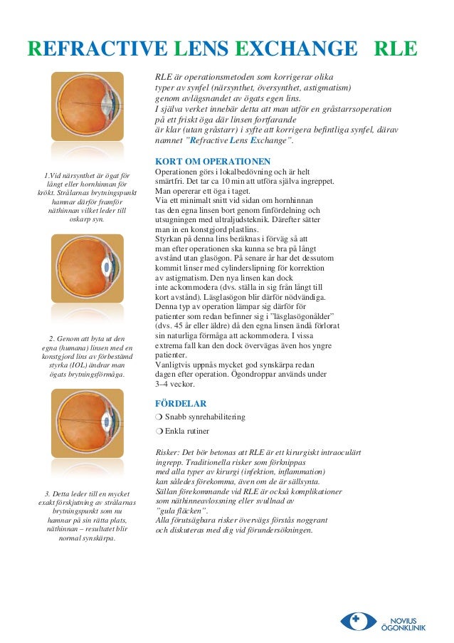 Refractive lens exchange (RLE)