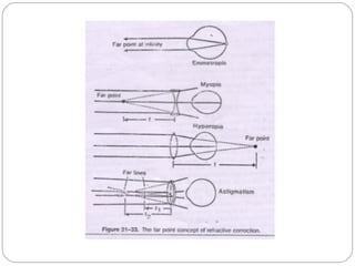 Refractive error | PPT
