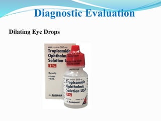 Diagnostic Evaluation
Dilating Eye Drops
 