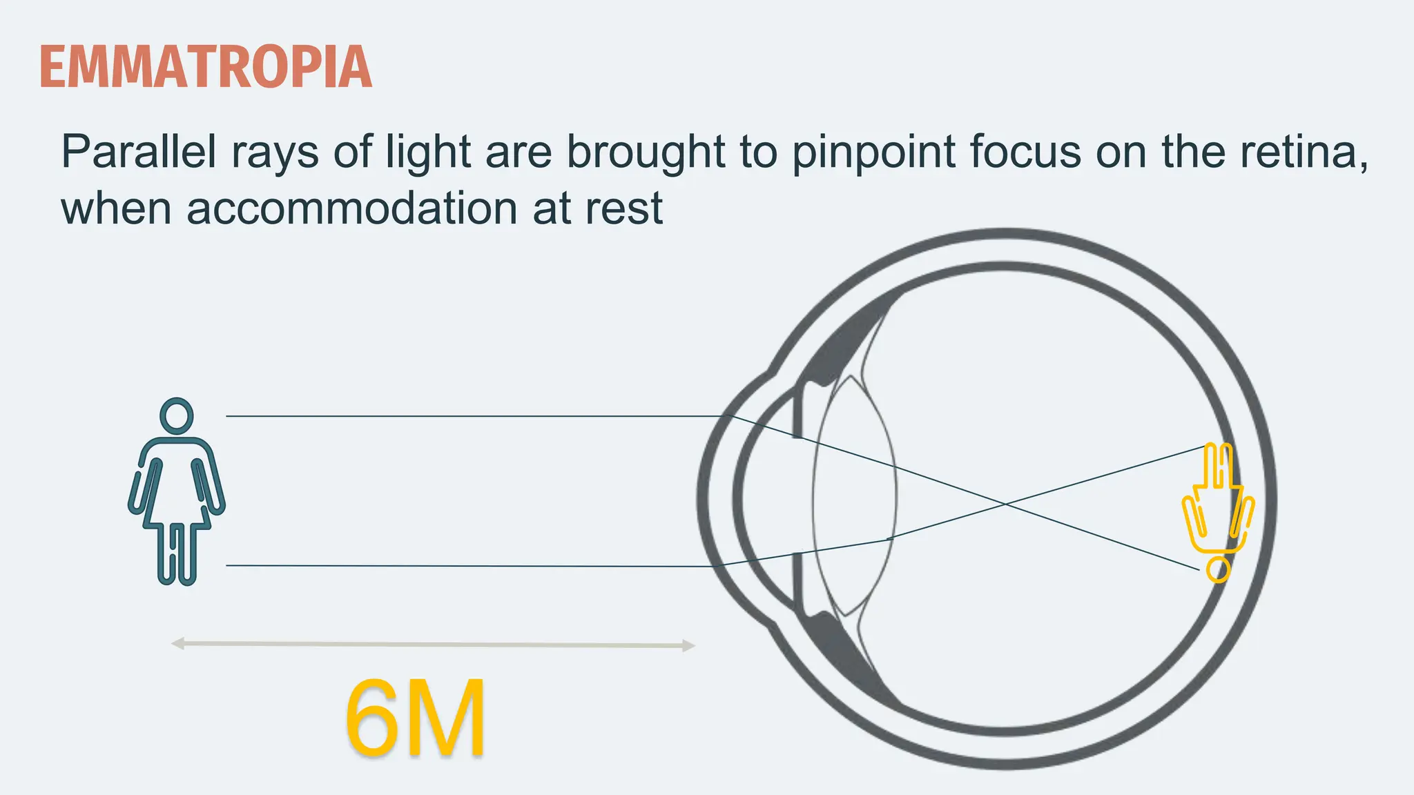6M
EMMATROPIA
Parallel rays of light are brought to pinpoint focus on the retina,
when accommodation at rest
 